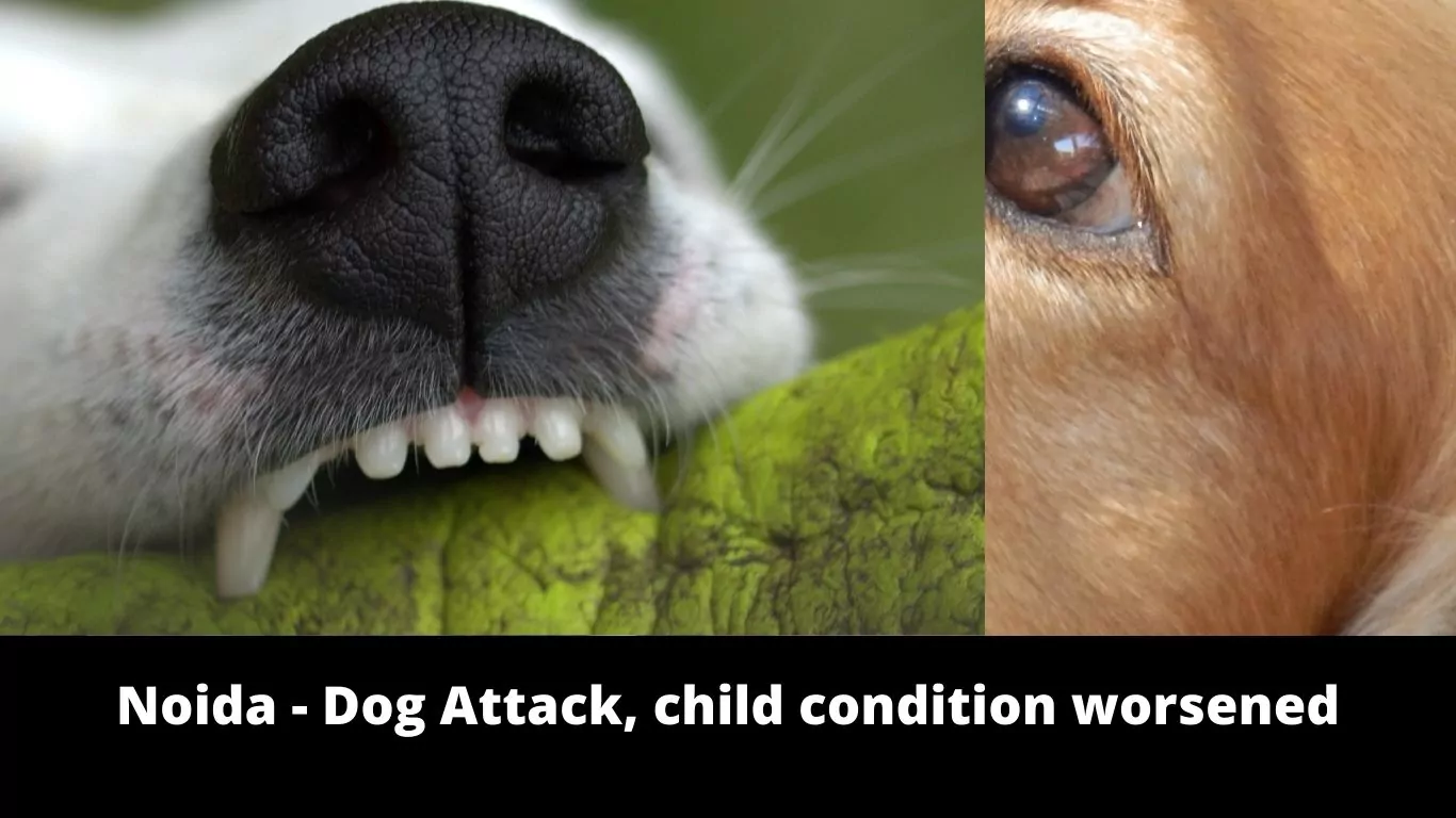 Noida - Dog Attack, child condition worsened